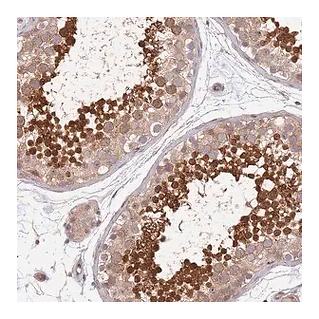 Merck Anti-TBX10 antibody produced in rabbit