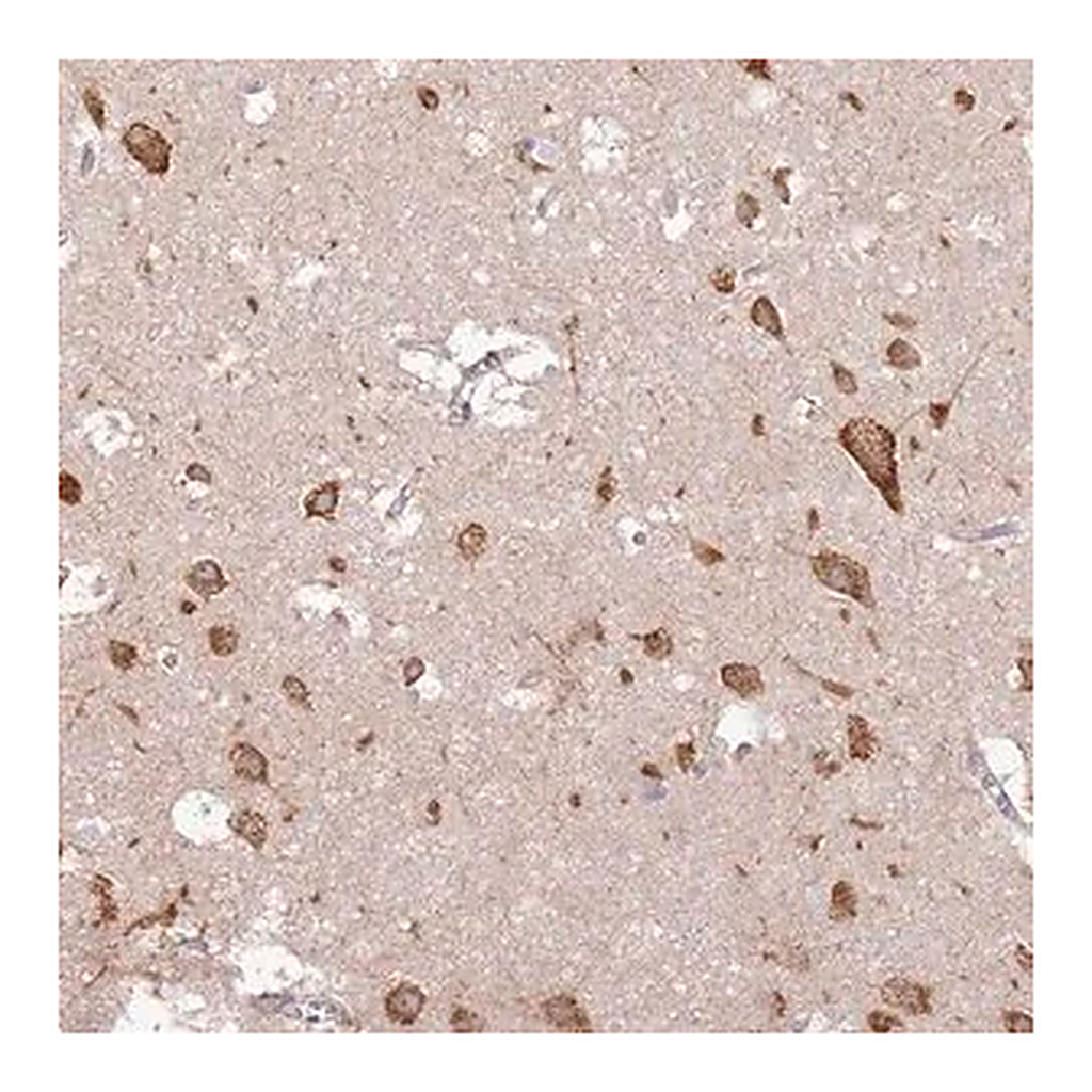 Merck Anti-UGGT2 antibody produced in rabbit
