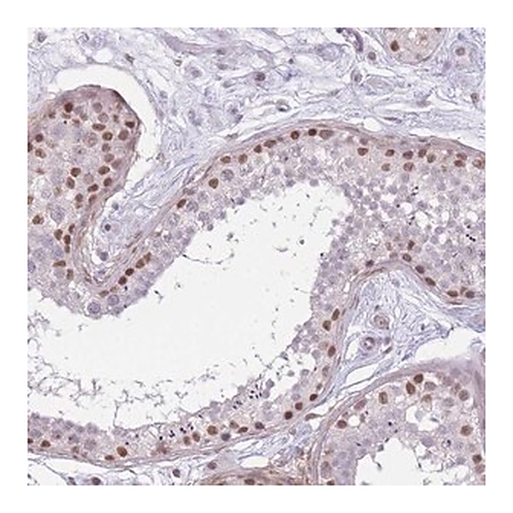 Merck Anti-SIN3B antibody produced in rabbit