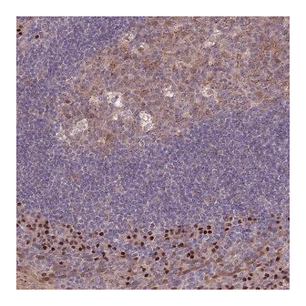 Merck Anti-ERCC6L antibody produced in rabbit