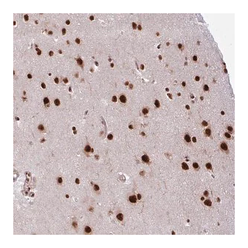 Merck Anti-CHERP antibody produced in rabbit