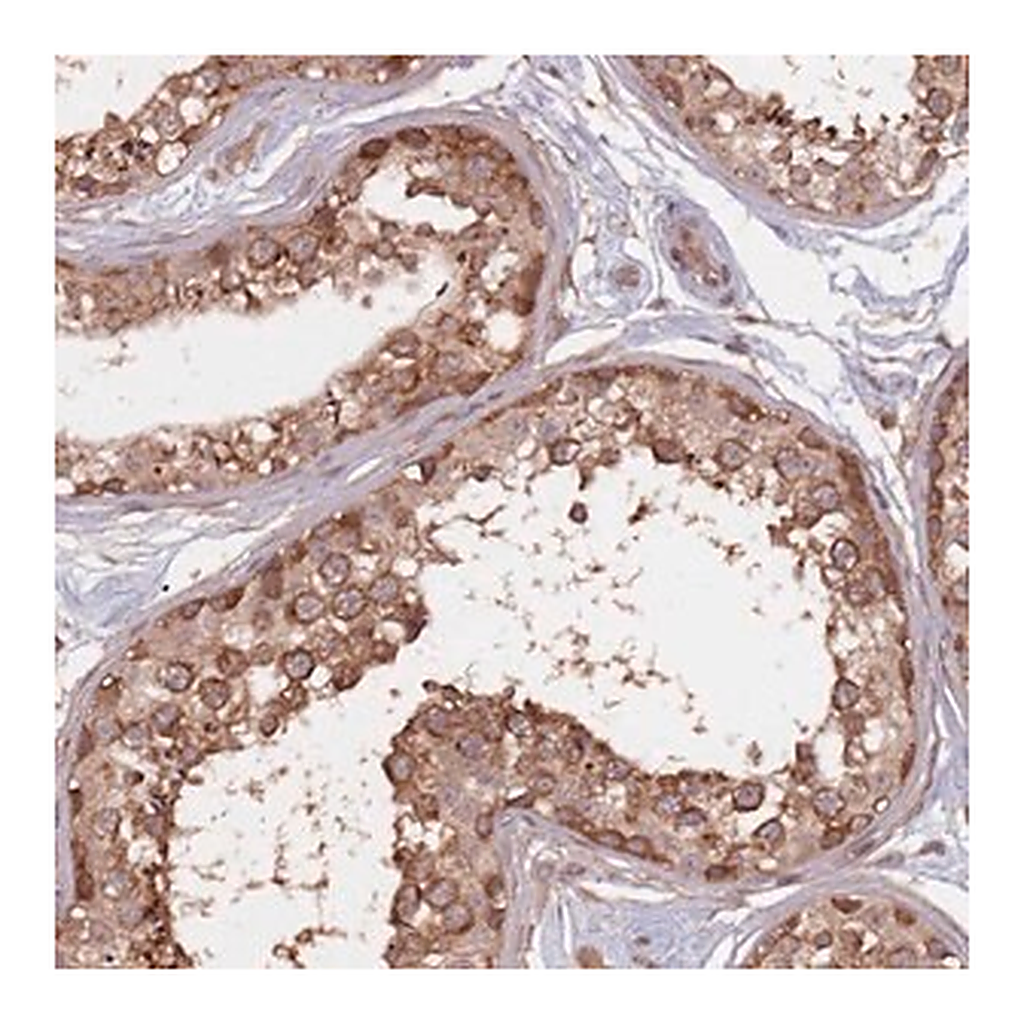 Merck Anti-C3ORF14 antibody produced in rabbit