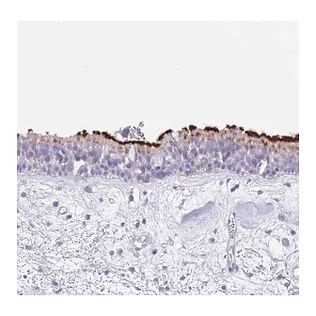Merck Anti-CPXM2 antibody produced in rabbit