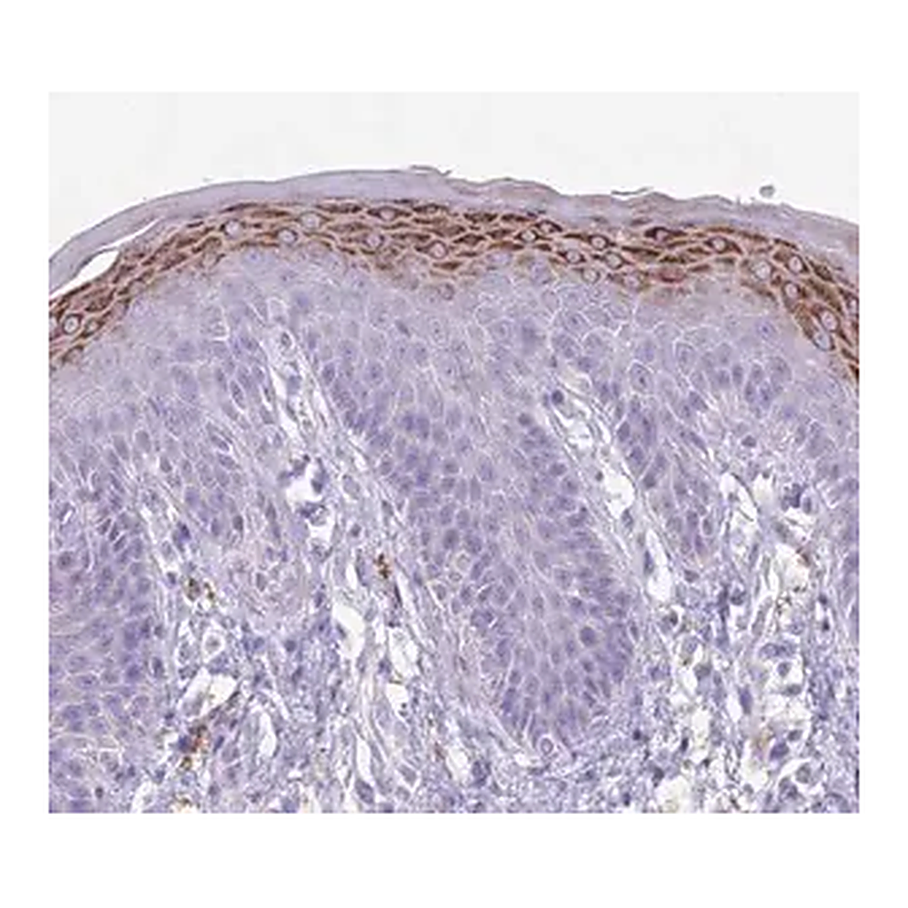 Merck Anti-CLEC2A antibody produced in rabbit