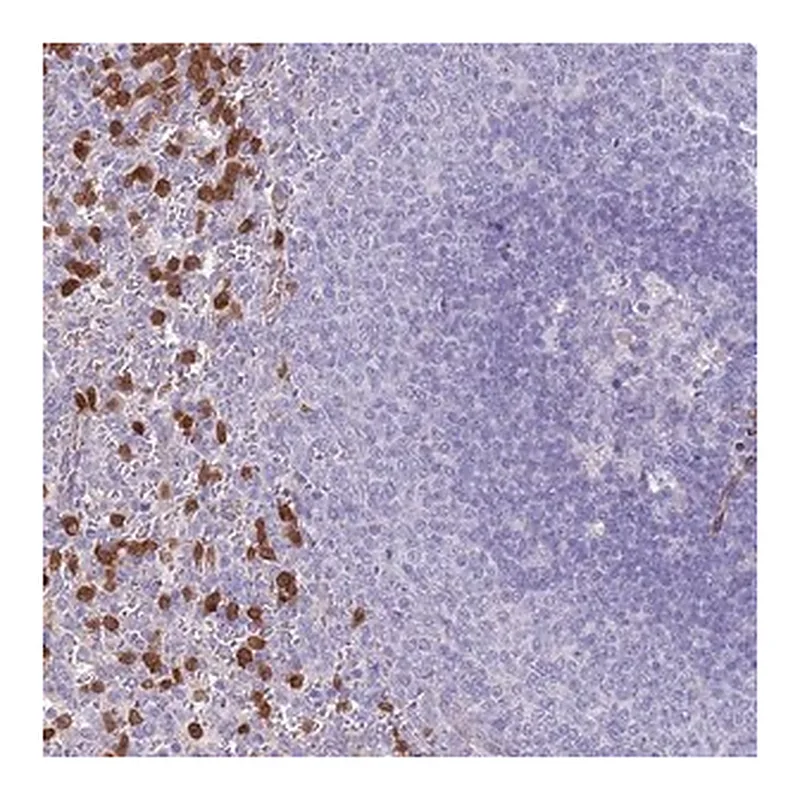 Merck Anti-PHLPP2 antibody produced in rabbit