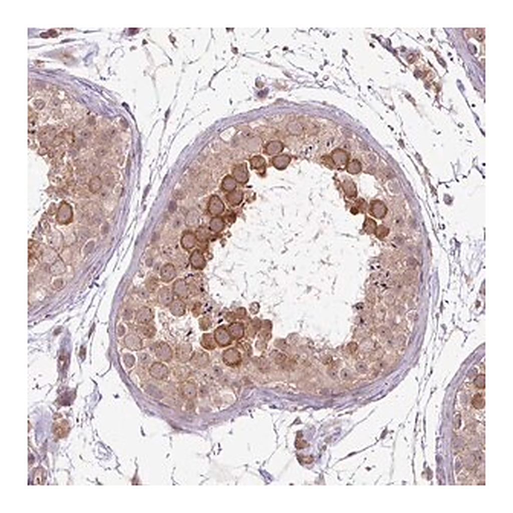 Merck Anti-DYX1C1 antibody produced in rabbit