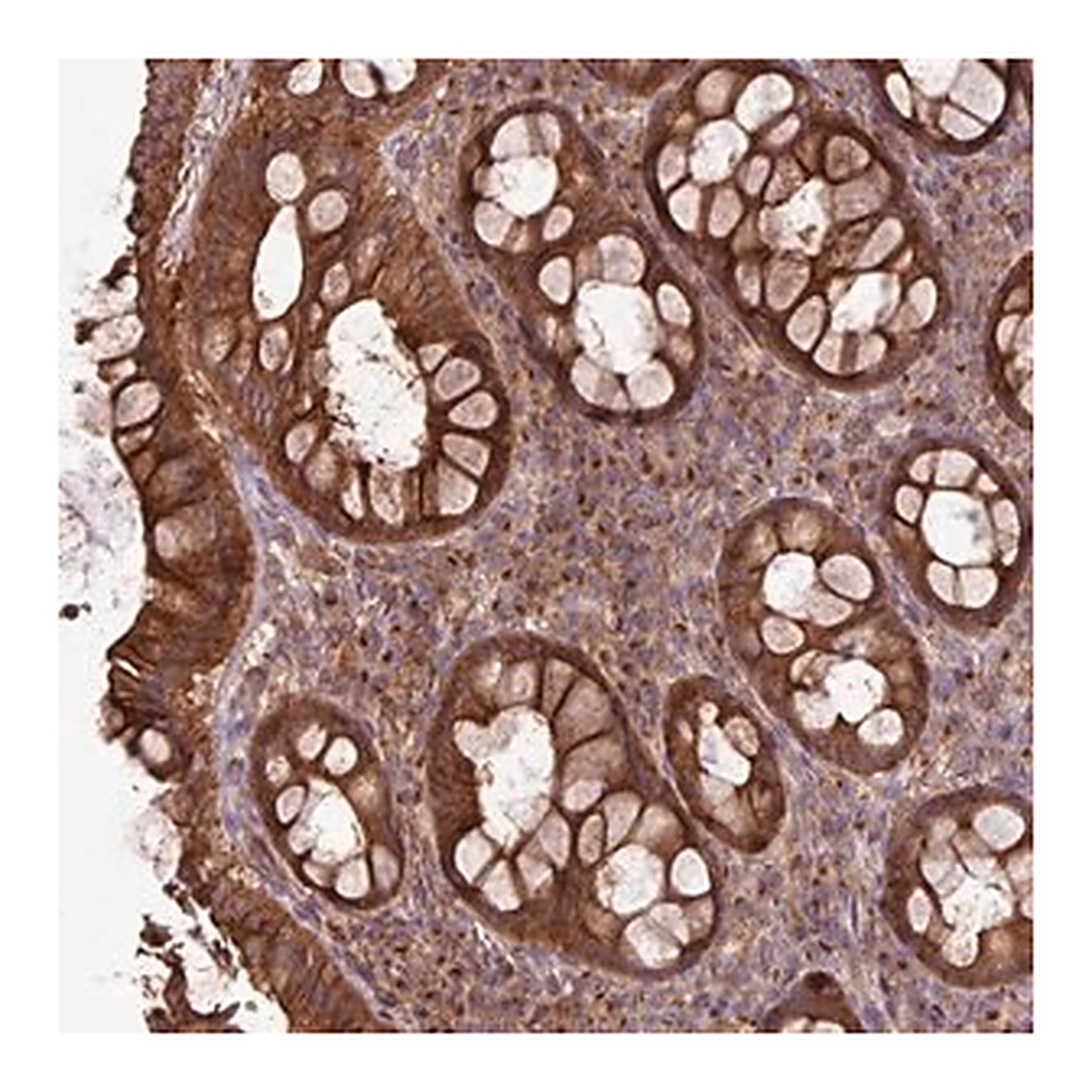 Merck Anti-RAB19 antibody produced in rabbit