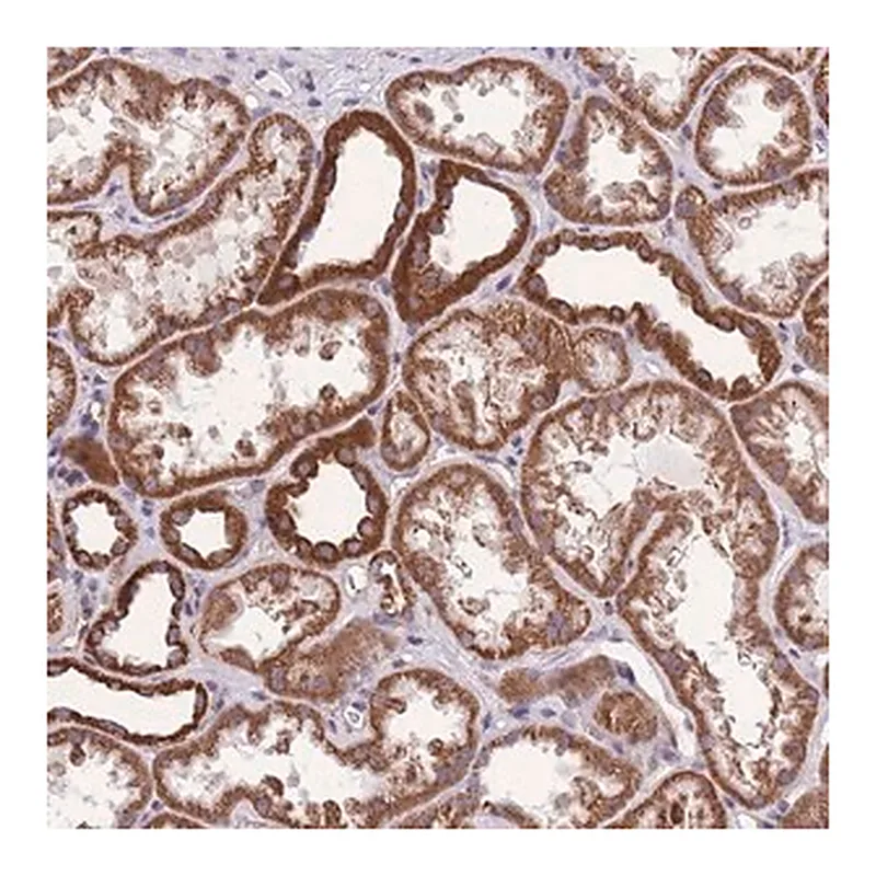Merck Anti-KCNH3 antibody produced in rabbit