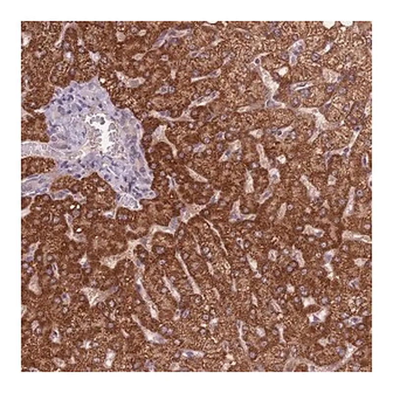 Merck Anti-KIAA1841 antibody produced in rabbit