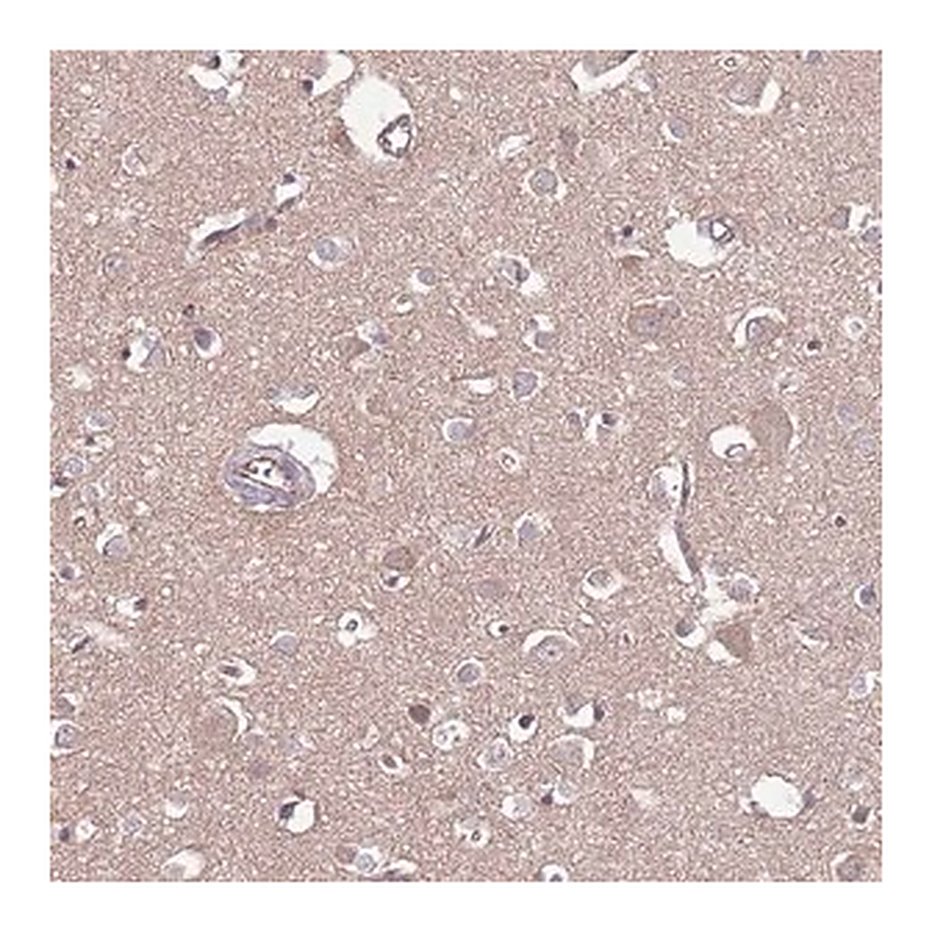 Merck Anti-DPP10 antibody produced in rabbit