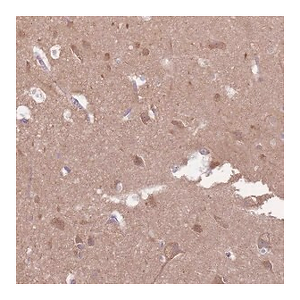 Merck Anti-EMC1 antibody produced in rabbit