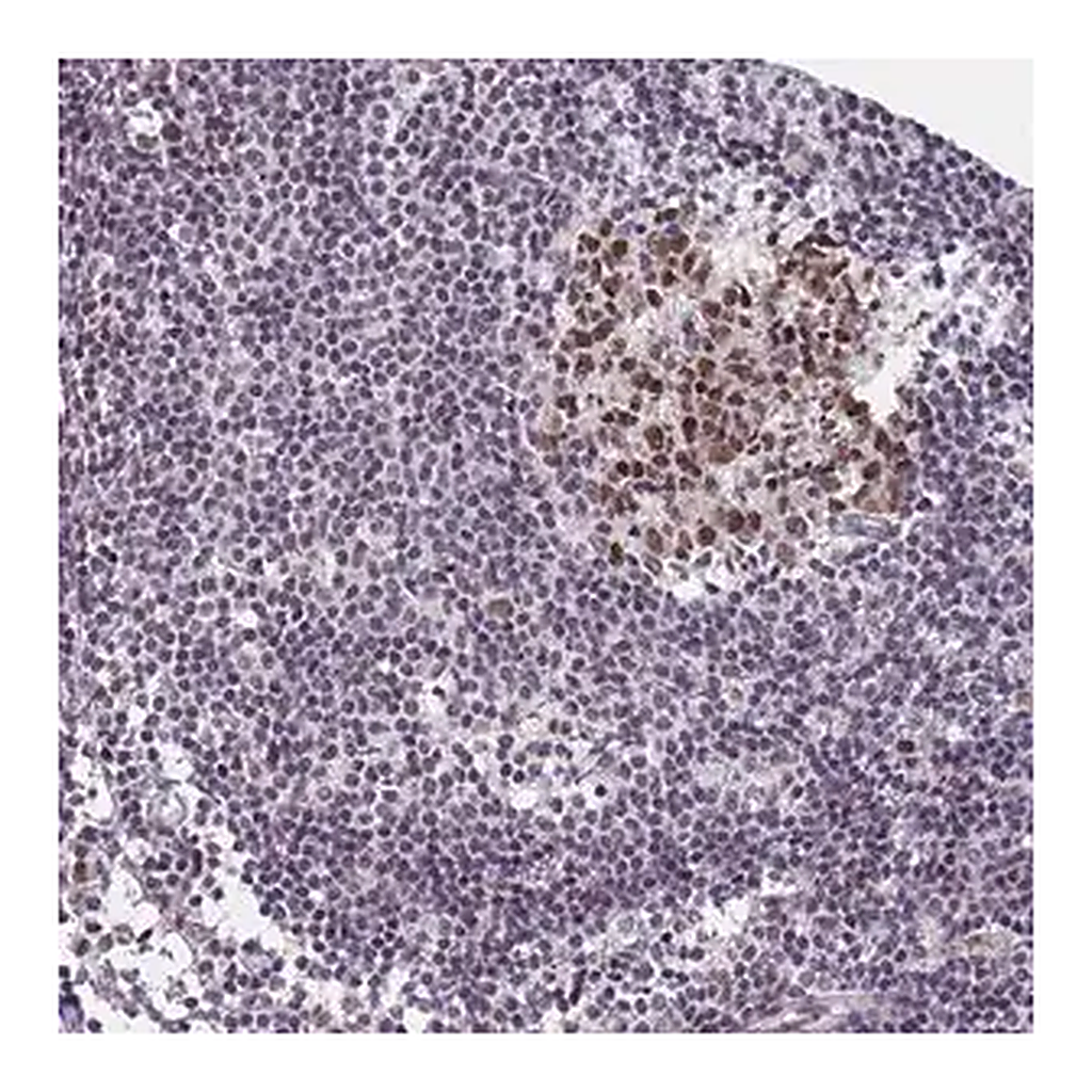 Merck Anti-SAMD1 antibody produced in rabbit