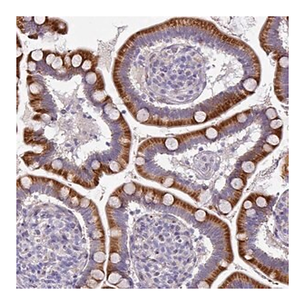 Merck Anti-KLHL3 antibody produced in rabbit