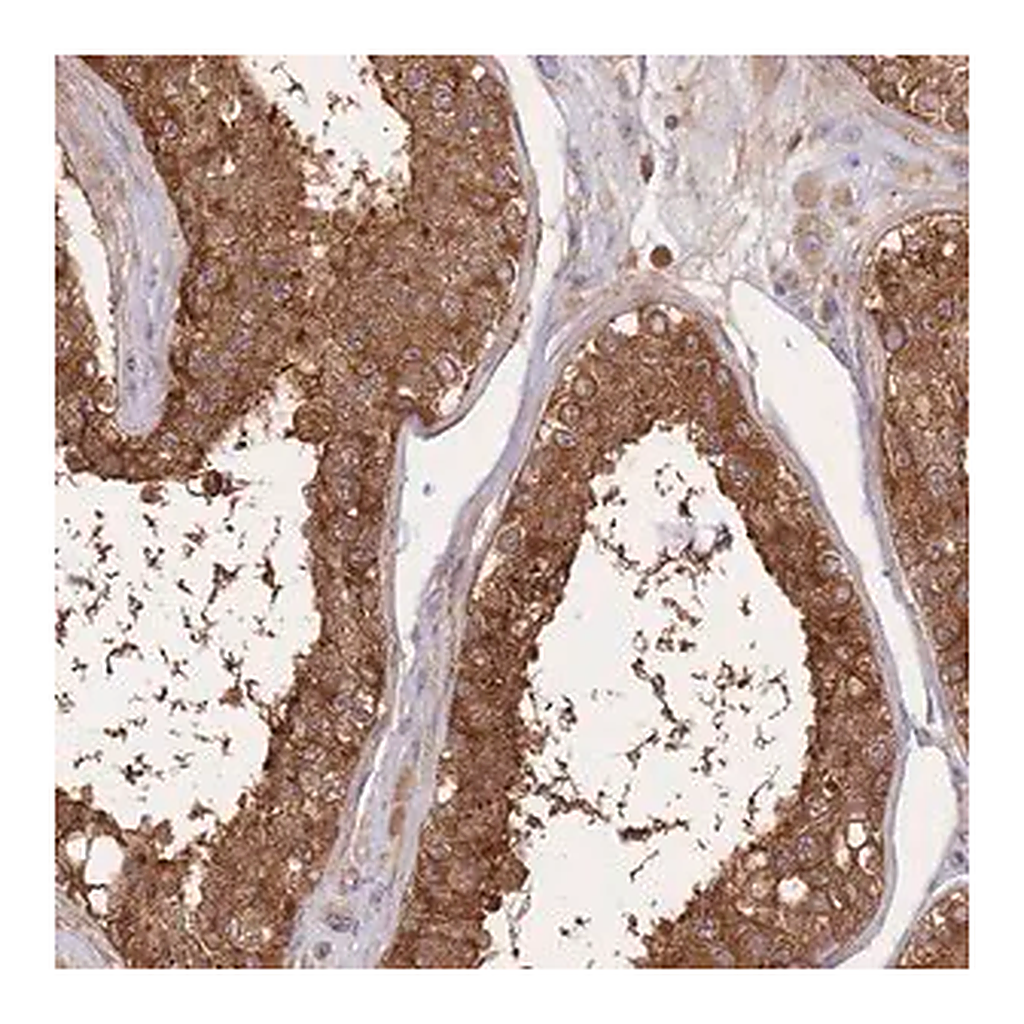 Merck Anti-SLC4A9 antibody produced in rabbit