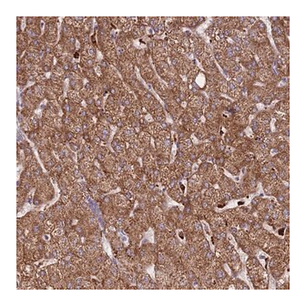 Merck Anti-TRIM61 antibody produced in rabbit