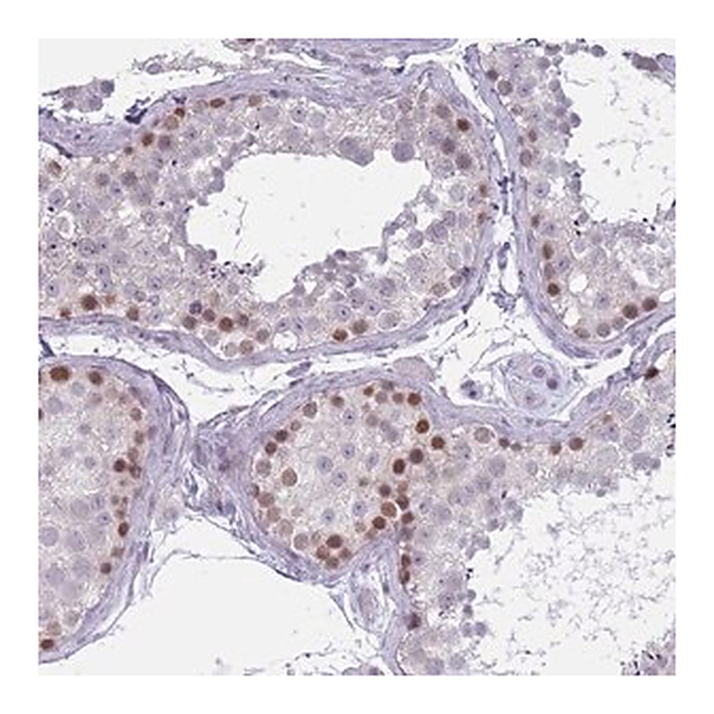 Merck Anti-ZKSCAN2 antibody produced in rabbit