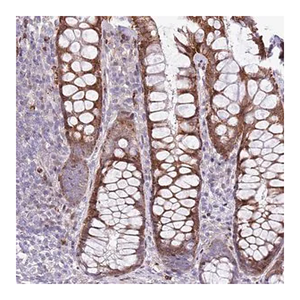 Merck Anti-ANO8 antibody produced in rabbit