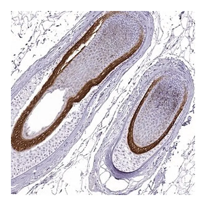 Merck Anti-KRT71 antibody produced in rabbit