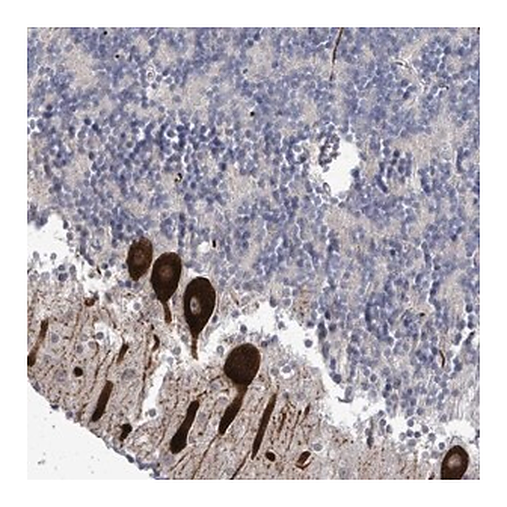 Merck Anti-AMMECR1 antibody produced in rabbit