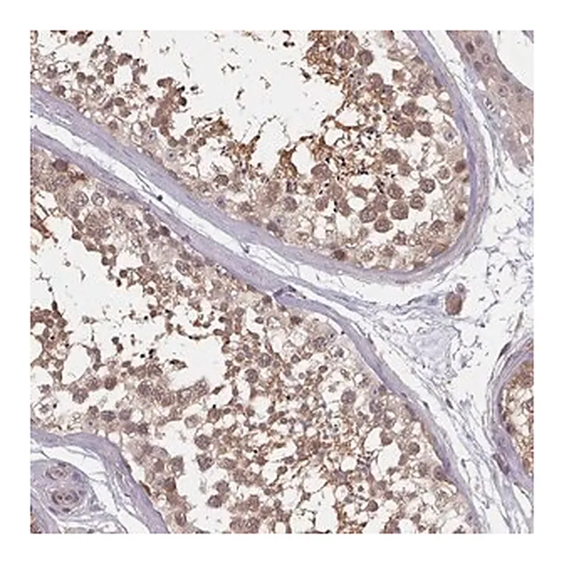 Merck Anti-HYAL3 antibody produced in rabbit