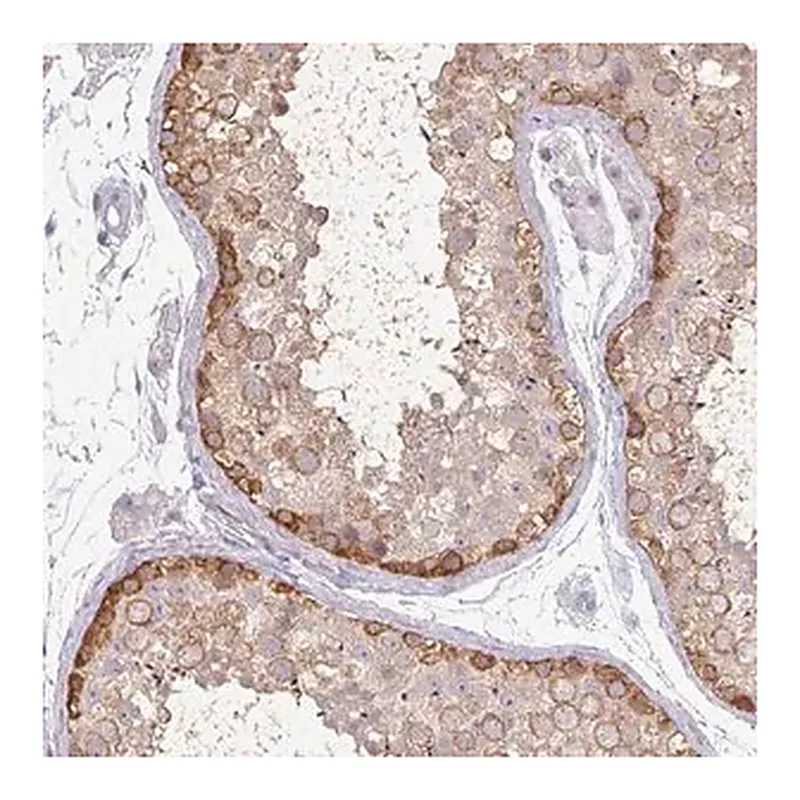 Merck Anti-MAGEC3 antibody produced in rabbit