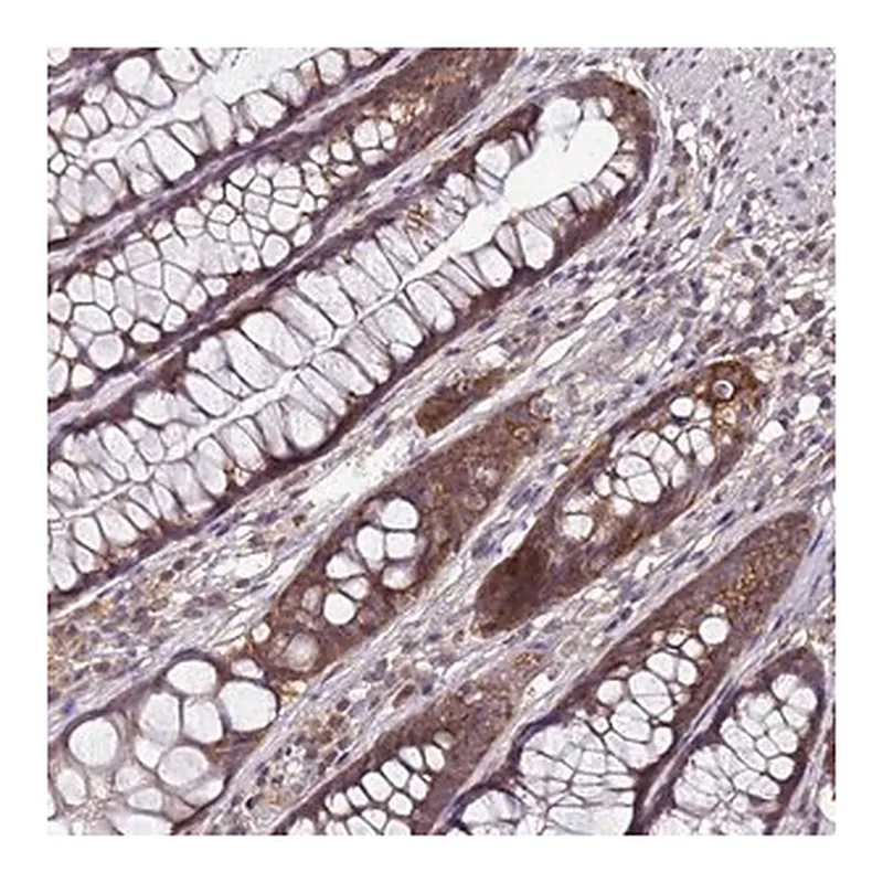 Merck Anti-ANKRD17 antibody produced in rabbit