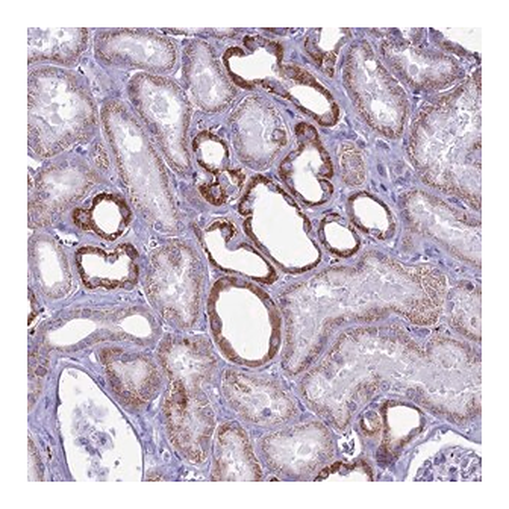 Merck Anti-C21orf140 antibody produced in rabbit