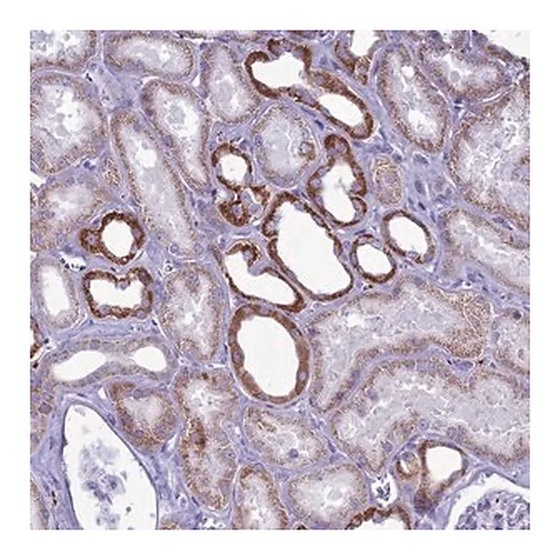 Merck Anti-C21orf140 antibody produced in rabbit