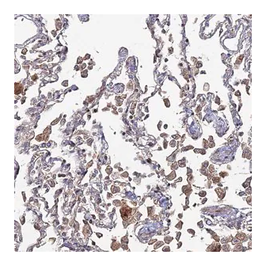 Merck Anti-SGMS1 antibody produced in rabbit