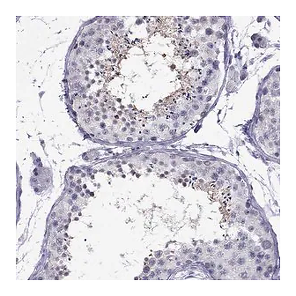 Merck Anti-CHRNB3 antibody produced in rabbit