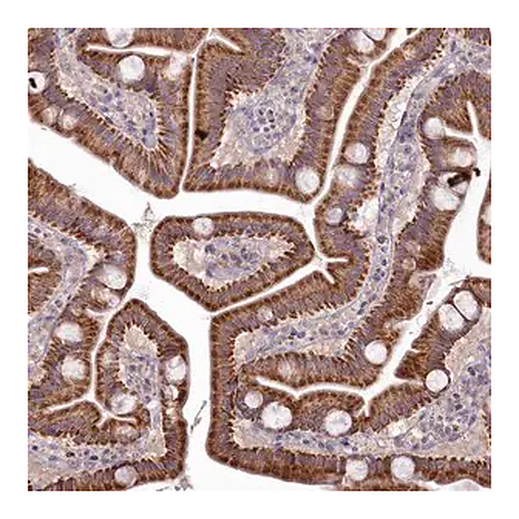 Merck Anti-MICU2 antibody produced in rabbit
