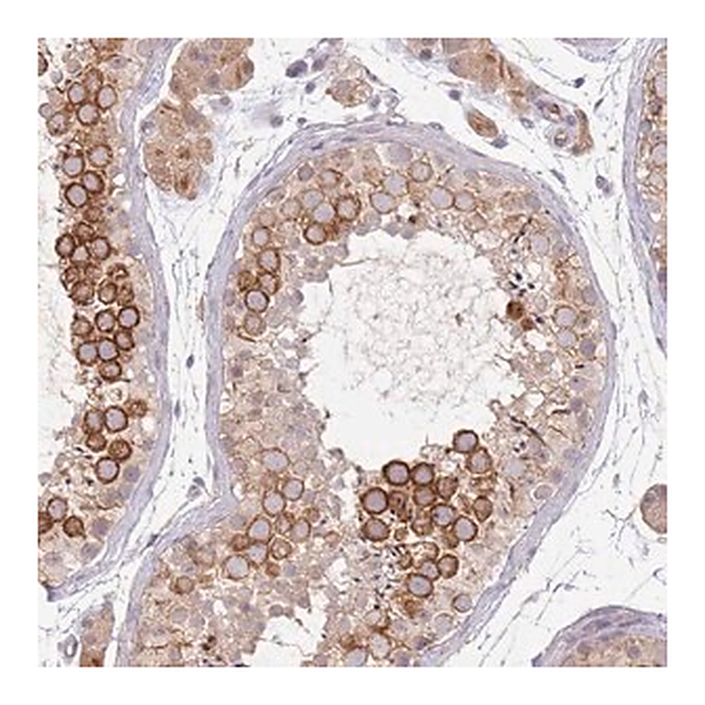 Merck Anti-NMUR2 antibody produced in rabbit