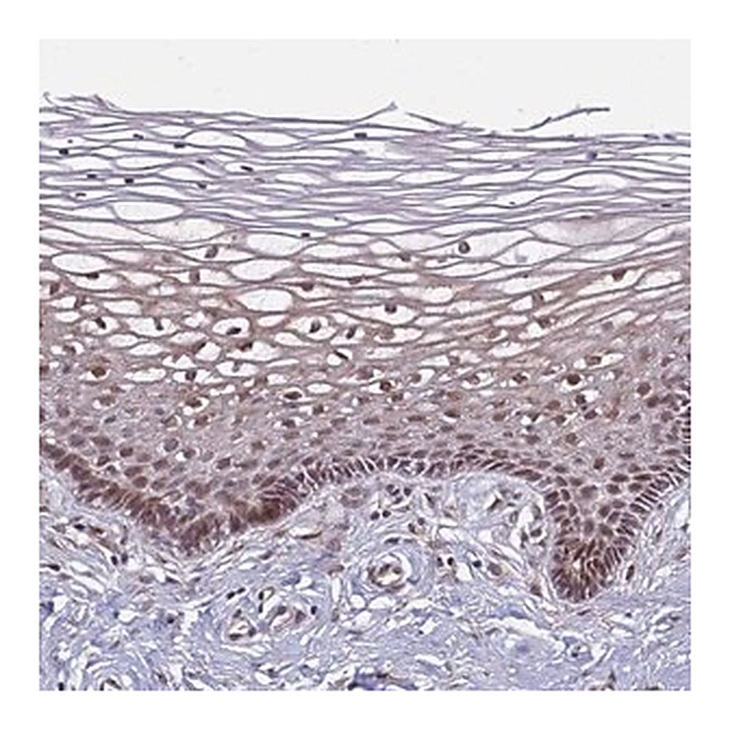 Merck Anti-POLR2D antibody produced in rabbit