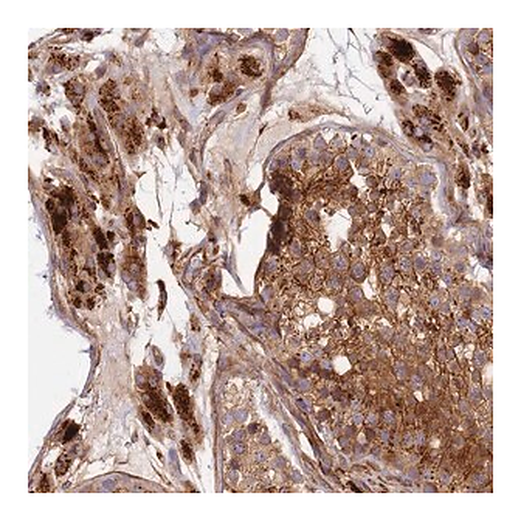 Merck Anti-C2CD5 antibody produced in rabbit