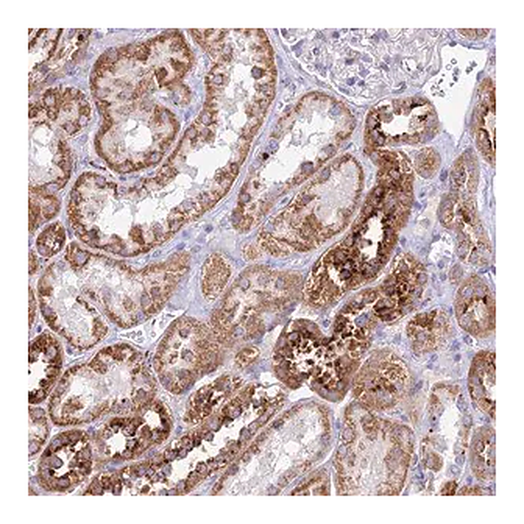 Merck Anti-PNLIPRP3 antibody produced in rabbit