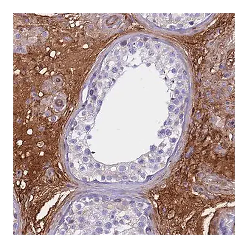 Merck Anti-CRHBP antibody produced in rabbit