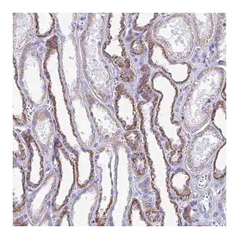 Merck Anti-ACSM1 antibody produced in rabbit