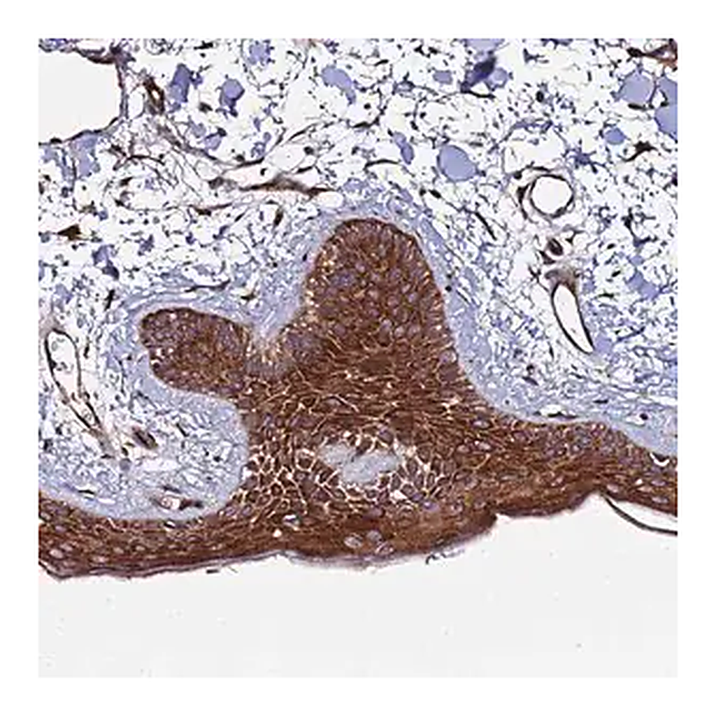 Merck Anti-TMC2 antibody produced in rabbit