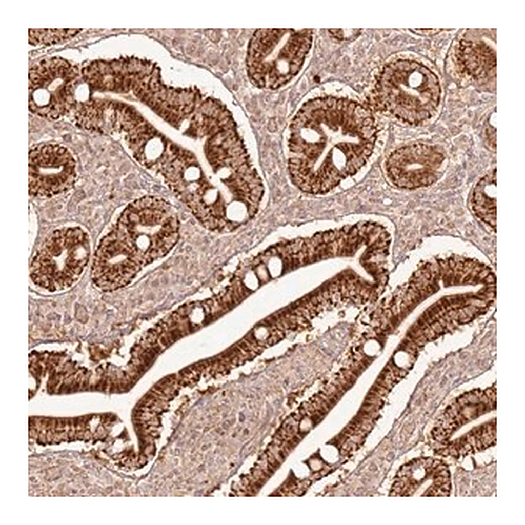 Merck Anti-ZNF776 antibody produced in rabbit