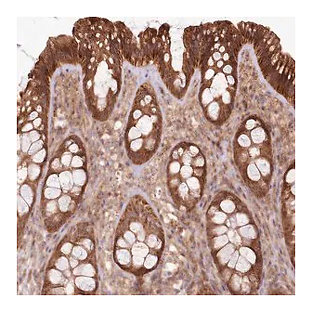 Merck Anti-RASA3 antibody produced in rabbit