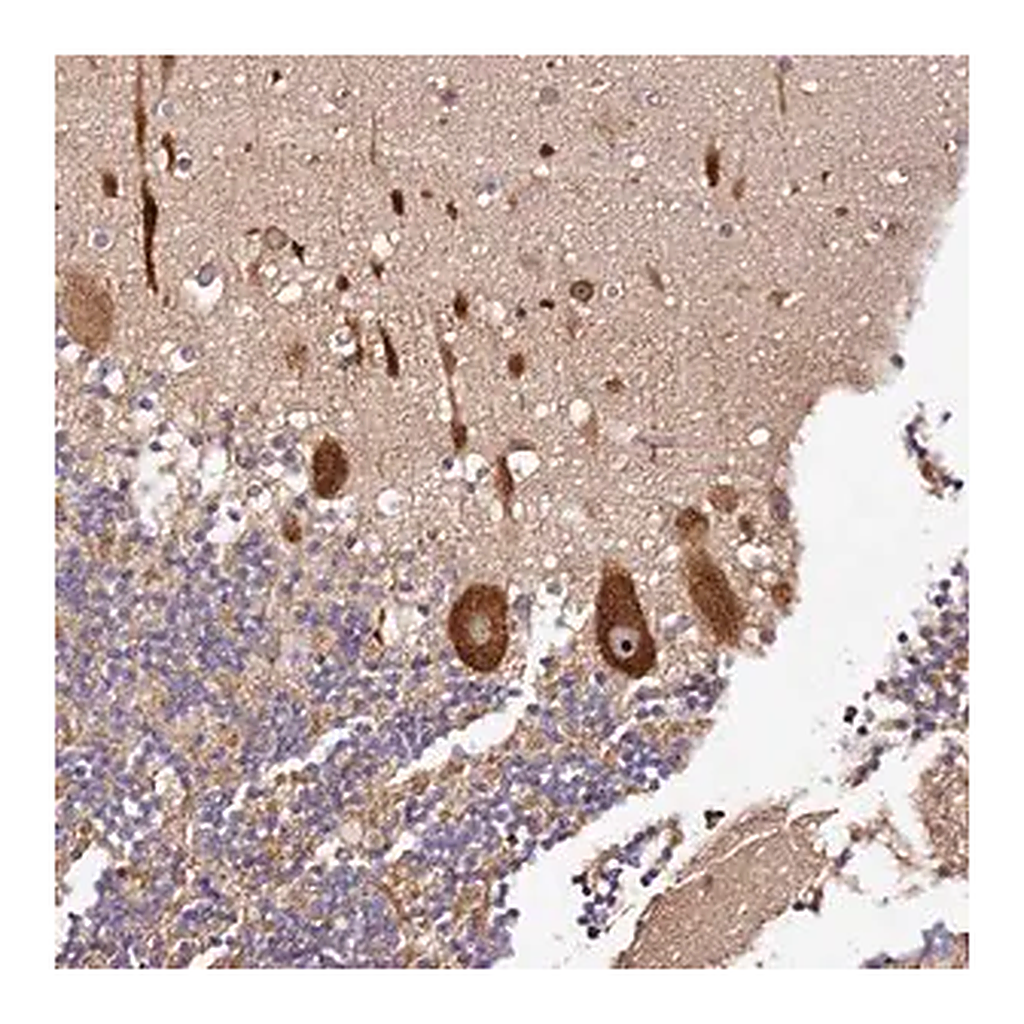 Merck Anti-DDX27 antibody produced in rabbit