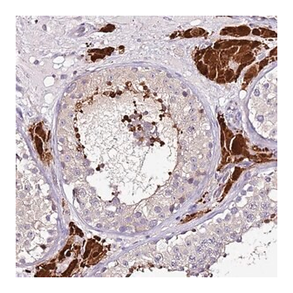 Merck Anti-SRRM5 antibody produced in rabbit