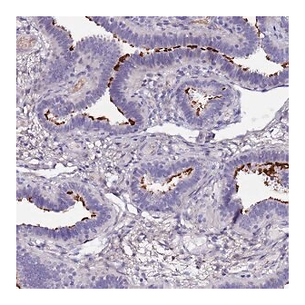 Merck Anti-C3orf80 antibody produced in rabbit