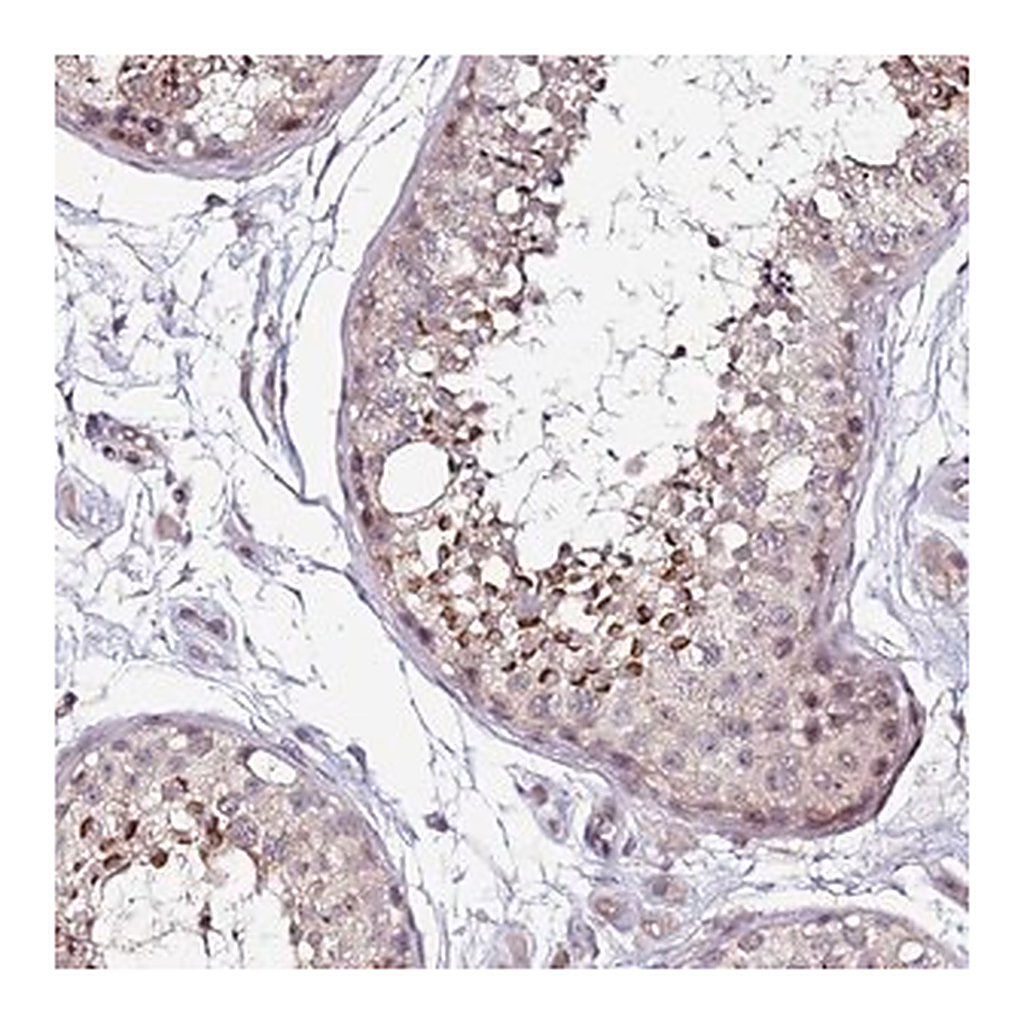 Merck Anti-DUSP28 antibody produced in rabbit