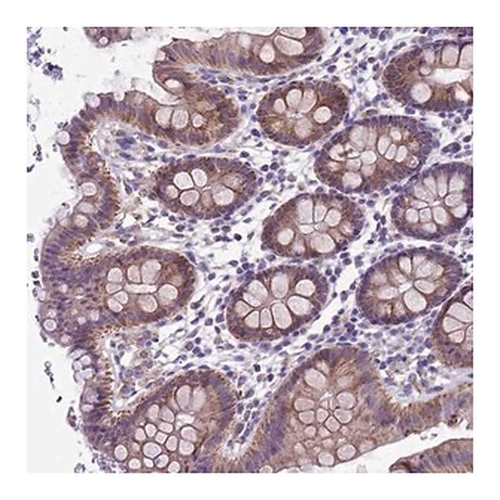 Merck Anti-CCDC191 antibody produced in rabbit
