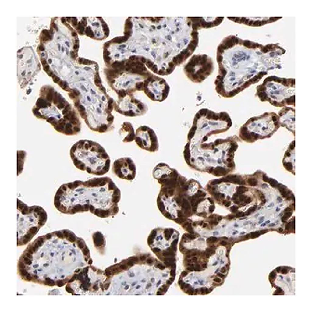 Merck Anti-MAGEA10 antibody produced in rabbit