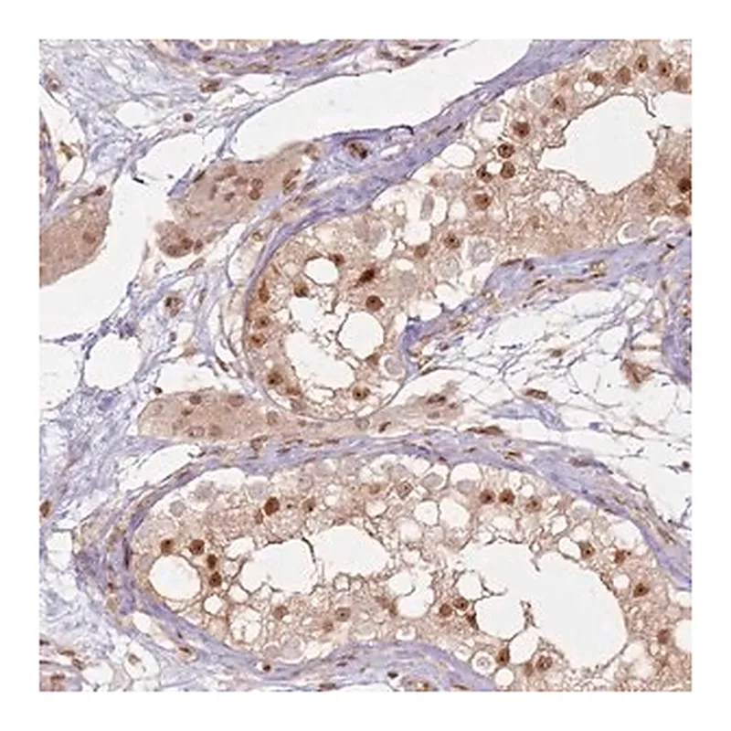 Merck Anti-KLHL36 antibody produced in rabbit