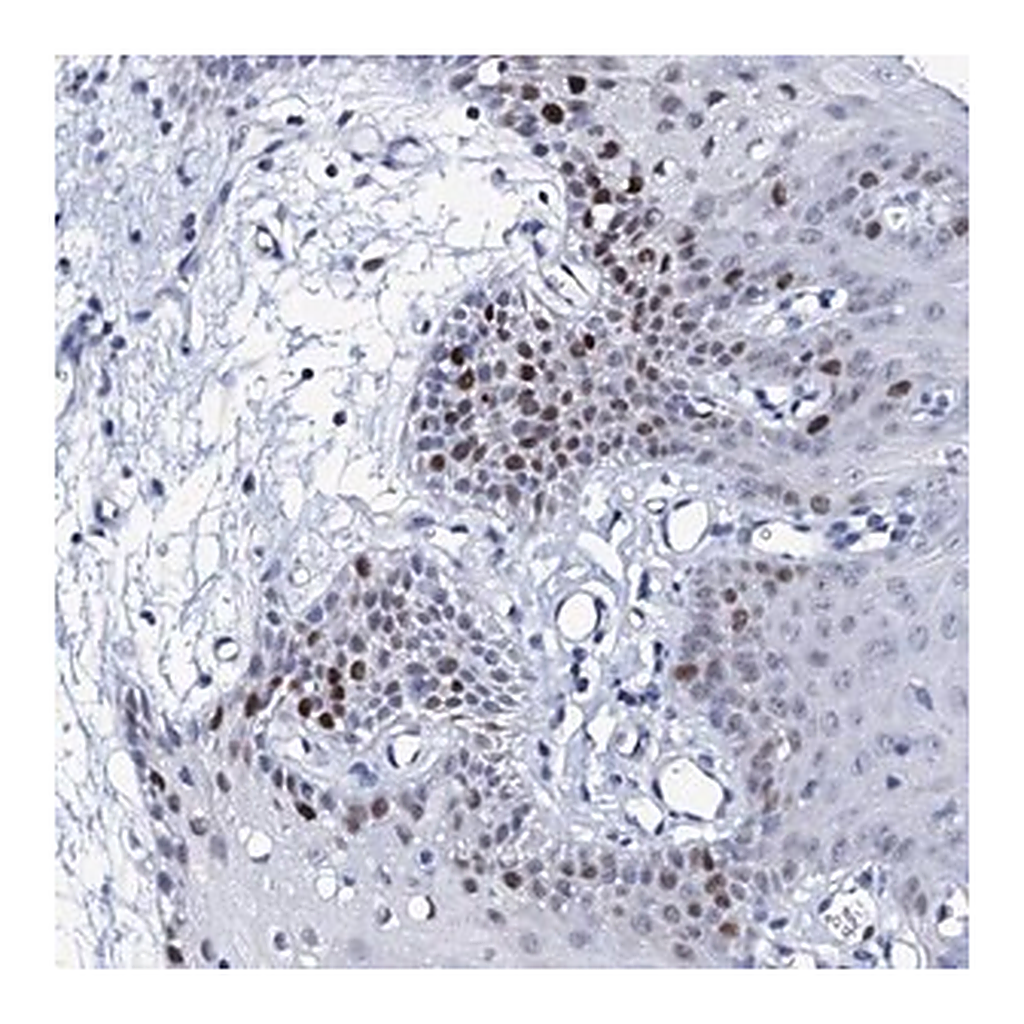 Merck Anti-NUDT13 antibody produced in rabbit