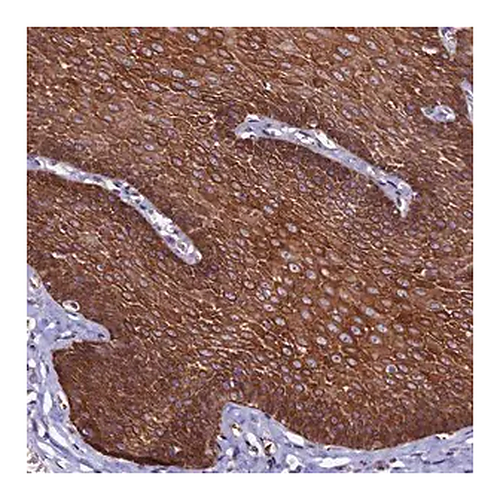 Merck Anti-CTDSPL2 antibody produced in rabbit