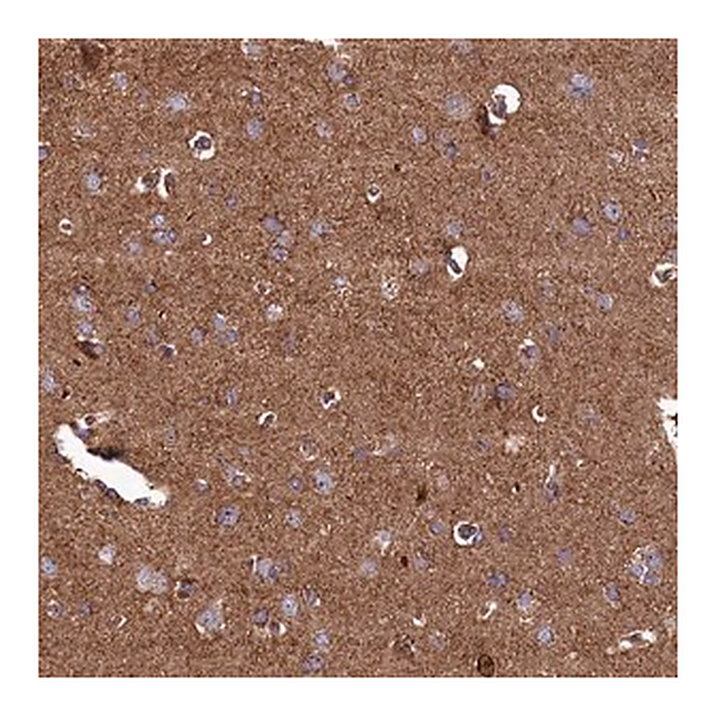 Merck Anti-UBE3B antibody produced in rabbit